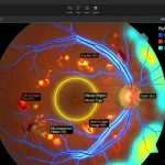 AI based Retinal Image Analysis: 7 Powerful Clinical Insights and Applications