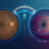 Retinal Fundus Image Analysis