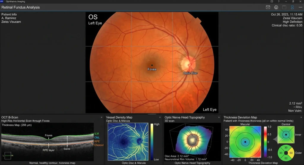 Retinal Image Analysis- Complete Retinal Analysis-2