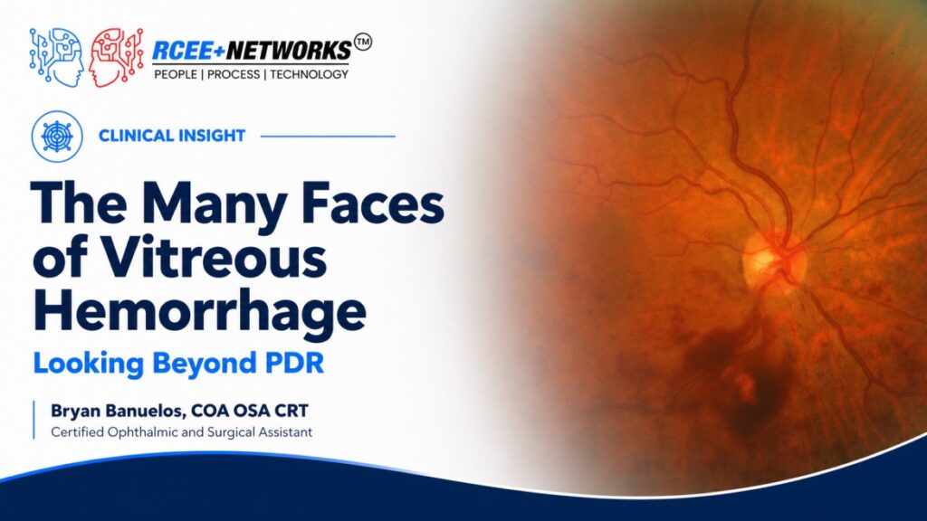 The Many Faces of Vitreous Hemorrhage: Looking Beyond PDR